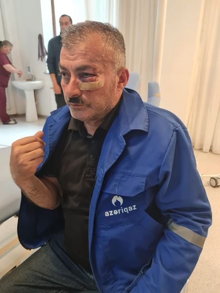 Borclu abonent yaba ilə “Azəriqaz”ın işçilərini HƏDƏLƏDİ: Birini yaraladı - FOTO